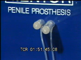 Thumbnail of Penile Prosthesis